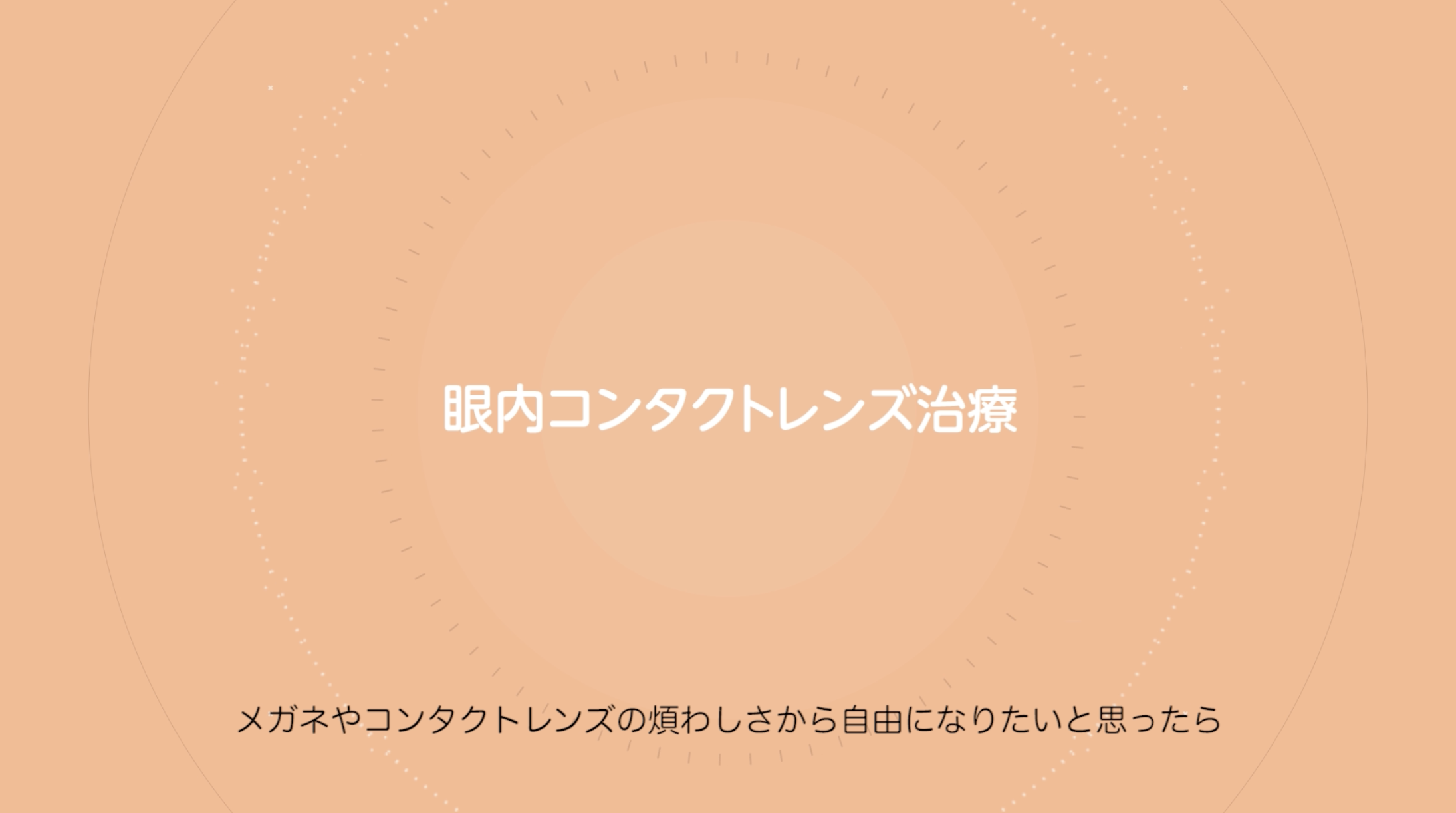 ICL手術なら鹿児島そのだ眼科｜近視・乱視を矯正する新技術ICL